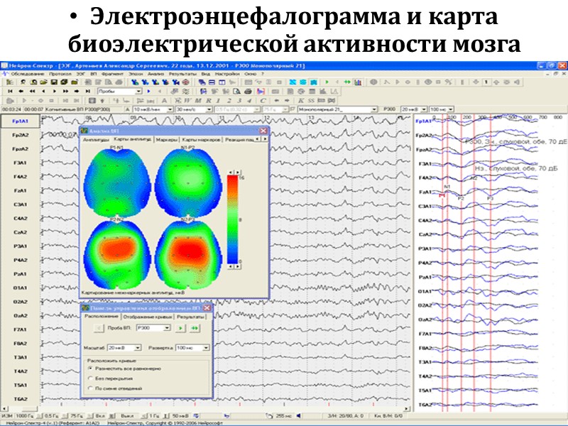Электроэнцефалограмма и карта  биоэлектрической активности мозга
